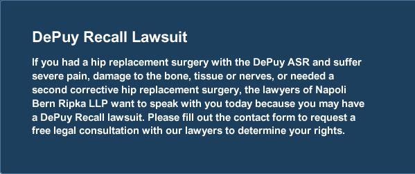 depuy recall lawsuits